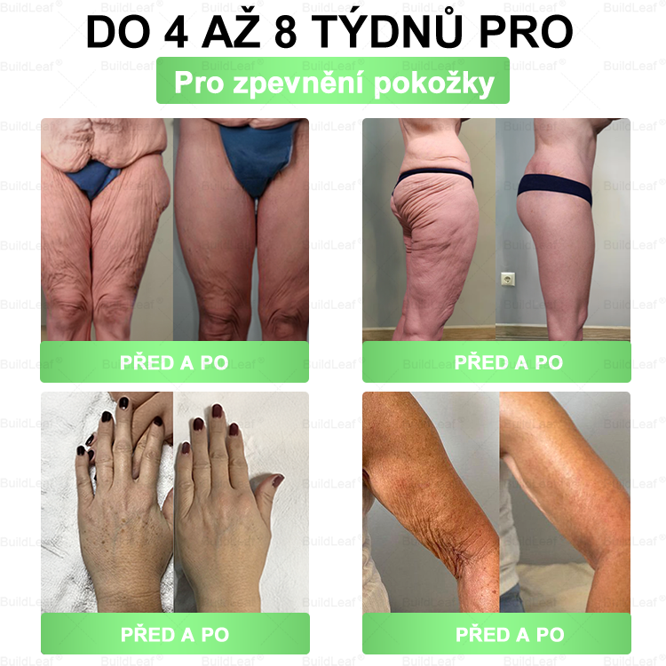 🎉 BuildLeaf® má pro tebe překvapení! Na další objednávku získáš až −70% slevu po dobu 2 minut! 🔥 Neváhej — nabídka za chvíli zmizí! ⏰👇